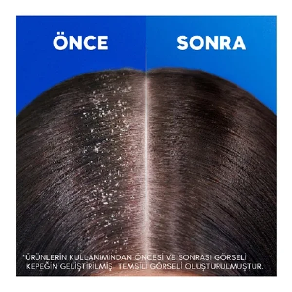 Head & Shoulders Klasik Bakım 2'si 1 Arada 300 ml Kepek Şampuanı - Görsel 8