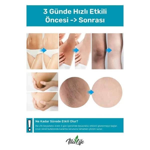 Illa Life Whitening Expert Hızlı Etkili Diş Jel Yeni Nesil Diş Beyazlatma Ve Temizleme Jeli 50 Ml - Görsel 6