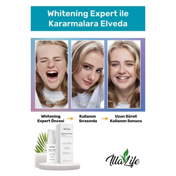 Illa Life Whitening Expert Hızlı Etkili Diş Jel Yeni Nesil Diş Beyazlatma Ve Temizleme Jeli 50 Ml - Görsel 5