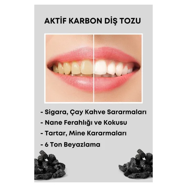 For You Gold Aktif Karbon Diş Temizleme Tozu 50 Gr Extra Beyazlatıcı Diş Tozu + Nane - Görsel 7