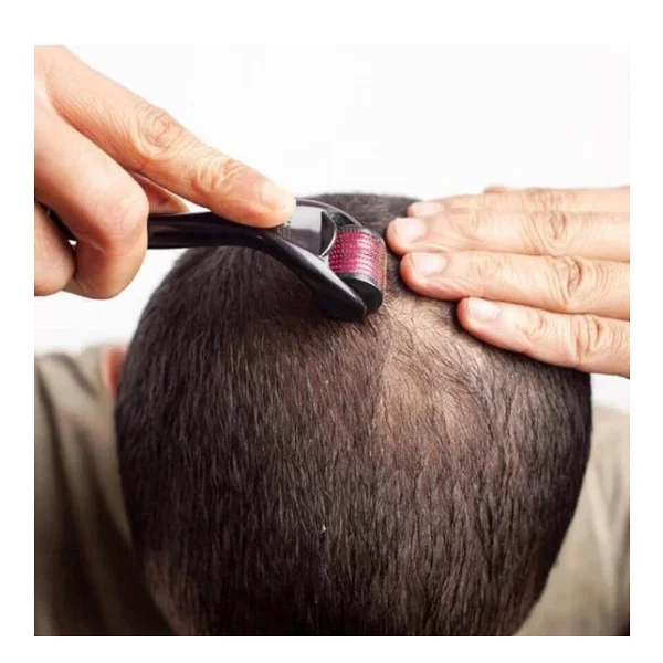 Yüz, Vücut ve Saç Derisi Için Derma Roller 1.0mm - 540 Micor Roller ile Erkekler ve Kadınlar Için Derma Rulo - Saç ve Sakal Için Sakal Rulo - Görsel 6
