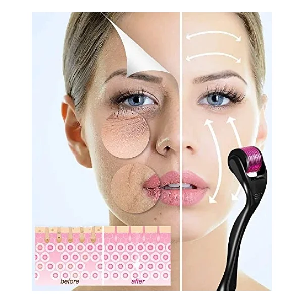 Yüz, Vücut ve Saç Derisi Için Derma Roller 1.0mm - 540 Micor Roller ile Erkekler ve Kadınlar Için Derma Rulo - Saç ve Sakal Için Sakal Rulo - Görsel 3