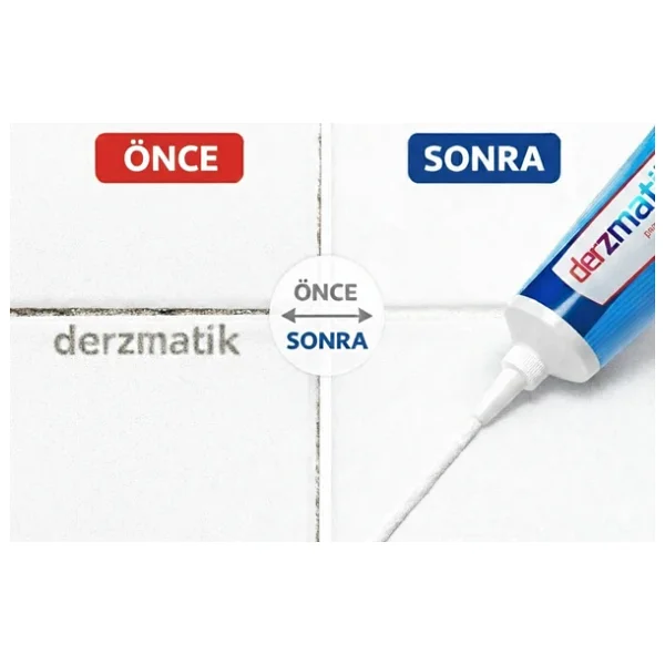 Derzmatik Tüp Derz Dolgu 380gr Beyaz - Görsel 5