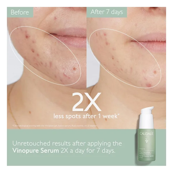 Caudalie Vinopure Akne Karşıtı Salisilik 30 ml Yüz Serumu - Görsel 2