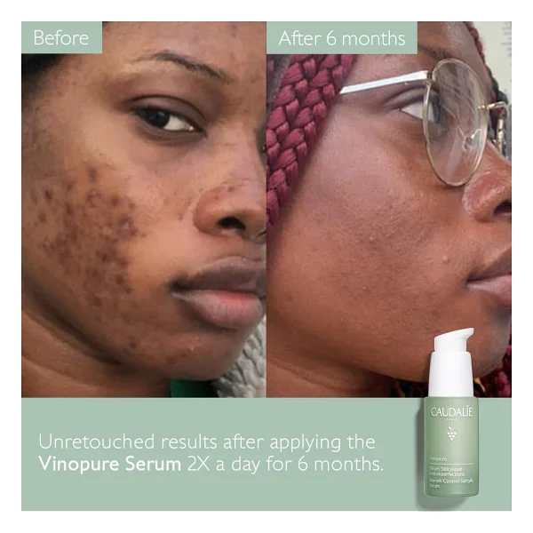 Caudalie Vinopure Akne Karşıtı Salisilik 30 ml Yüz Serumu - Görsel 5