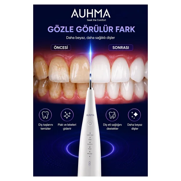Ultrasonic Şarjlı Elektrikli Akıllı Diş Temizleme Cihazı Beyazlatıcı 5 Mod 3+1 Başlık, Ipx8 Su Geçirmez Beyaz - Görsel 6