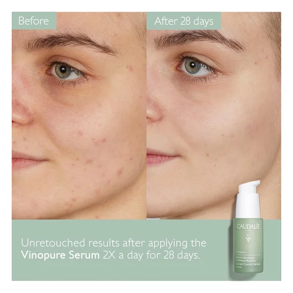 Caudalie Vinopure Akne Karşıtı Salisilik 30 ml Yüz Serumu - Görsel 8