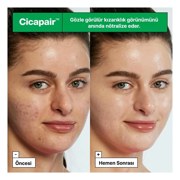 Dr. Jart+ Cicapair Tiger Grass 15 ml Cilt Tonu Eşitleyici Krem - Görsel 3