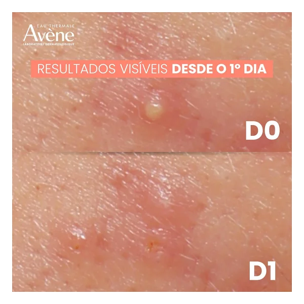 Avene Cleanance Comedomed Peeling 40 ml - Görsel 7