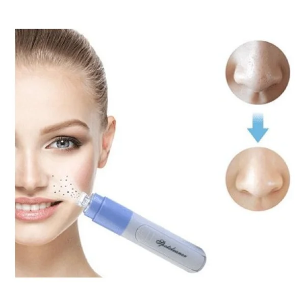 Öztekinler Pore Cleaner Yüz Temizleme Cihazı Vakumlu Siyah Nokta Temizleme Cihazı - Görsel 3