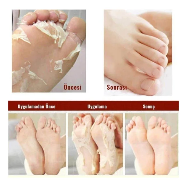 Marlett Foot Peeling Pack - Professıonal Çorap Tipi Ayak Peeling Maskesi 6'lı Set - Görsel 4