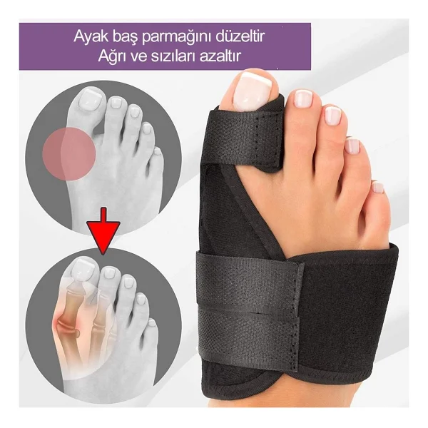 Ankaflex Ayak Ateli Halluks Valgs Bunion Sağ Sol Ayak Parmak Ateli Ayak Tarak Kemiği Düzleştirici Gece Ateli - Görsel 4