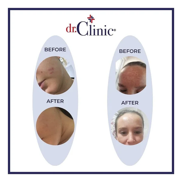 Dr. Clinic Lekeli Ciltler için C Vitamini Kremi 50 ml - Görsel 5
