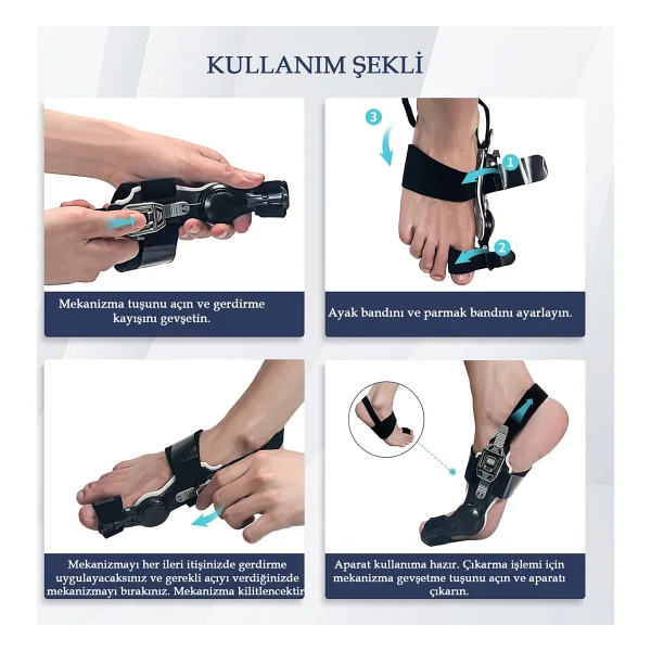 İnvoker Ayarlı Ayak Baş Parmak Kemik Düzeltici Başparmak Çıkıntısı Eğriliği Düzeltme Aparatı Halluks Valguss Aleti Gece Ateli - Siyah - Görsel 5