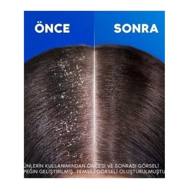 Head & Shoulders Ekstra Hacim 330 ml Kepek Şampuanı - Görsel 6