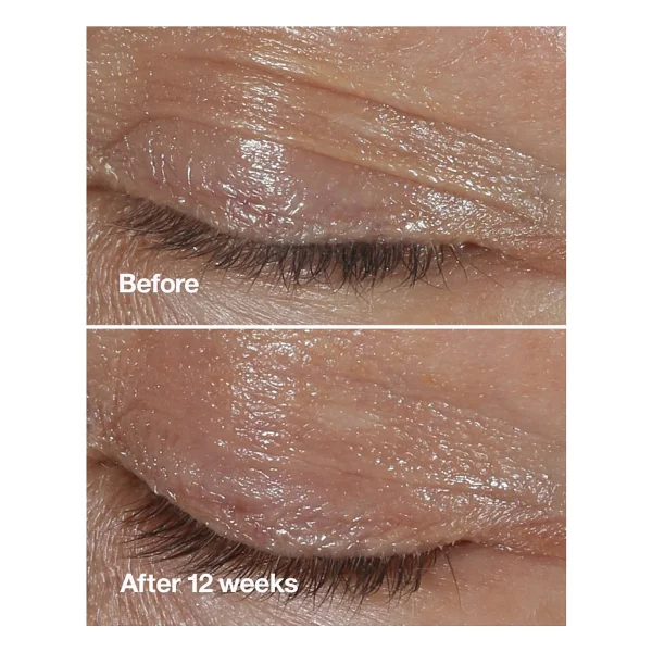 Clinique Smart Clinical RepairTM Kırışıklık Görünümü Karşıtı Göz Kremi 15ml - Görsel 9