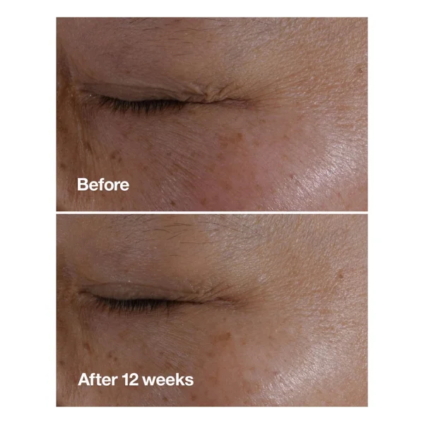 Clinique Smart Clinical RepairTM Kırışıklık Görünümü Karşıtı Göz Kremi 15ml - Görsel 10