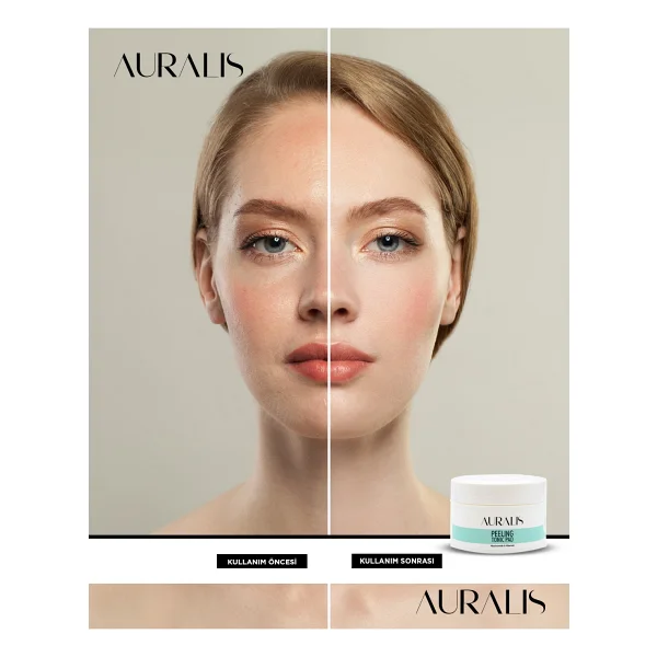 Auralis Peeling Tonik Pad Gözenek Sıkılaştırıcı ve Arındırıcı 40 Adet - Görsel 2