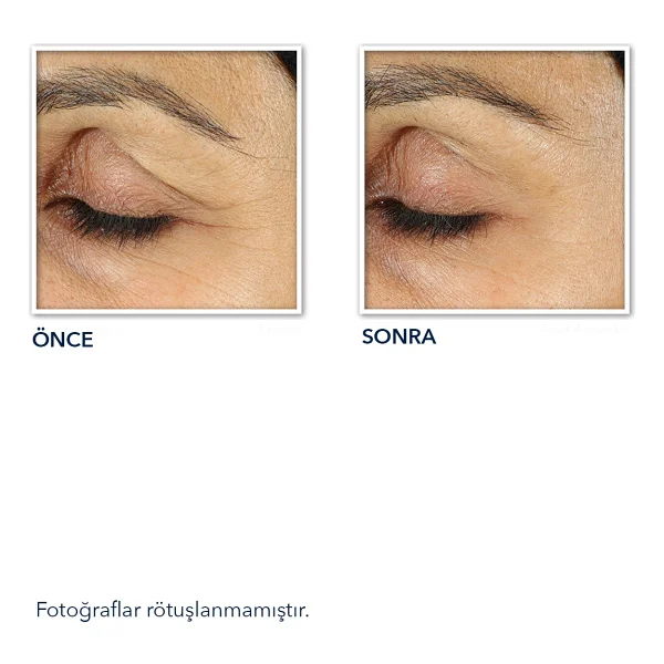 ROC Retinol Correxion Line Smoothing Eye Kırışıklık Karşıtı Göz Kremi 15 ml - Görsel 9