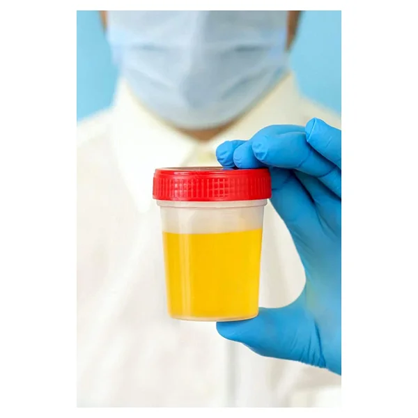 ATEL-SAN Idrar Numune Kabı Steril-100 Ml - 10 Adet - Görsel 7