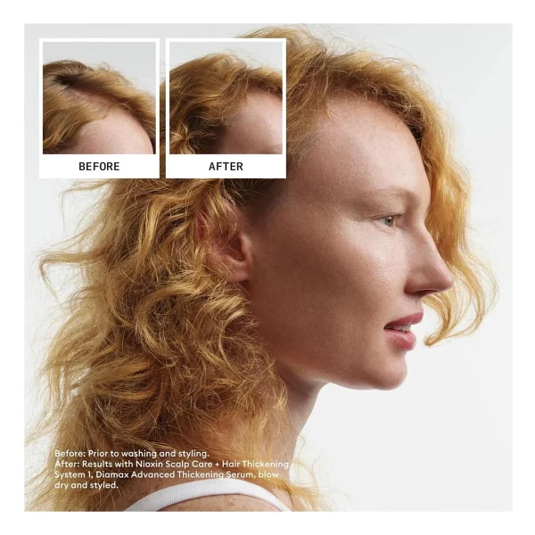 Nioxin System Kit 1 - İşlem Görmemiş Hafif İnce Saçlar İçin Kalınlaştırıcı Bakım - Görsel 4