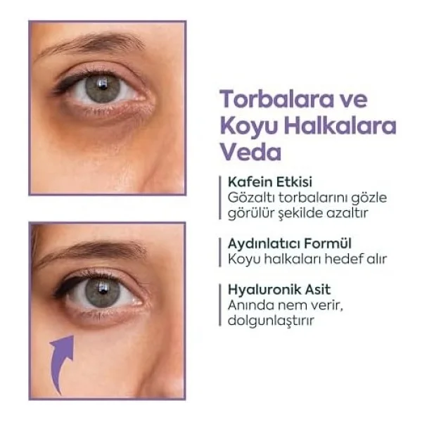 Clasycare Göz Altı Kremi - Kafein%5 + Hyaluronik Asit%2 - Morluk, Torba ve Şişlik Karşıtı Göz Kremi - Kırışıklık, Ince Çizgi ve Göz Altı Aydınlatıcı Krem, 40 ml - standart - Görsel 4