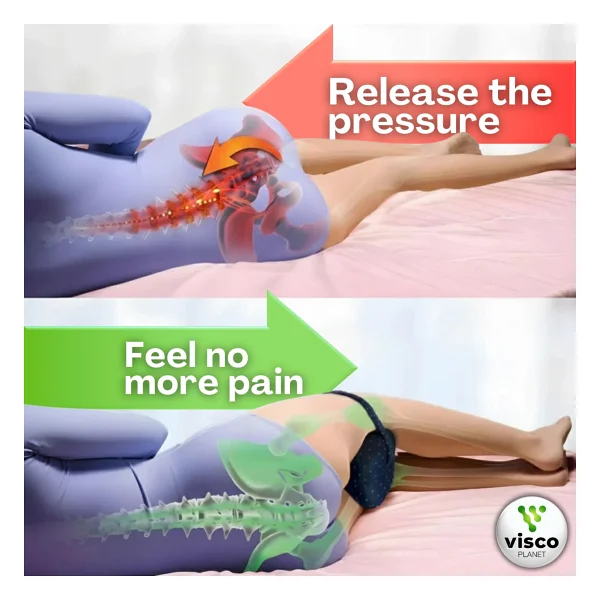 Visco Planet Ortopedik Bacak Arası Yan Yatış Yastığı Ergonomik Uyku Minderi Lastikli - Görsel 3