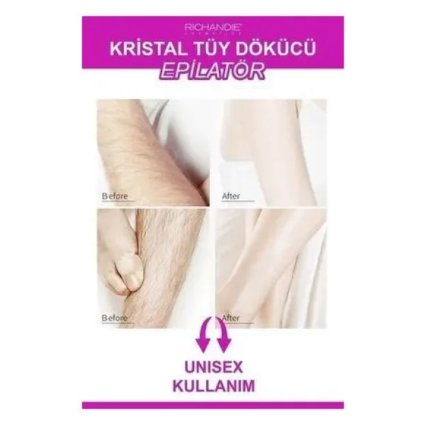 Kristal Tüy Dökücü Ağda Epilatör Crystal Eraser Epilasyon Aleti Tüy Silgisi Tüy Alıcı Fiziksel Pembe - Görsel 2