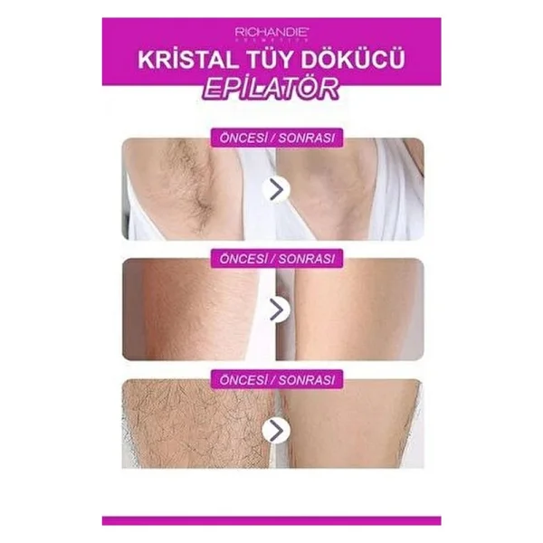 Kristal Tüy Dökücü Ağda Epilatör Crystal Eraser Epilasyon Aleti Tüy Silgisi Tüy Alıcı Fiziksel Pembe - Görsel 4