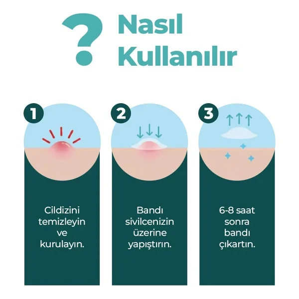 kleccs Sivilce Bandı, Orijinal-Profesyonel Bakım, 144 Adet, Hidrokolloid Akne Bandı - Görsel 5