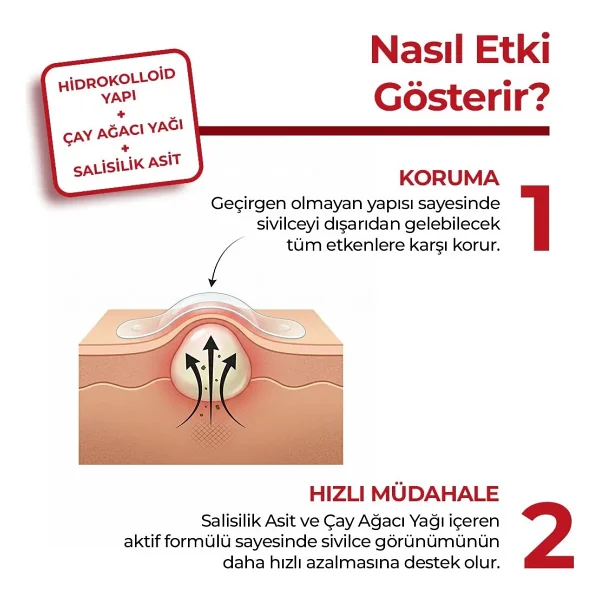 kleccs Sivilce Bandı, Aktif-Hızlı Sonuç, 144 Adet, Hidrokolloid Akne Bandı - Görsel 4