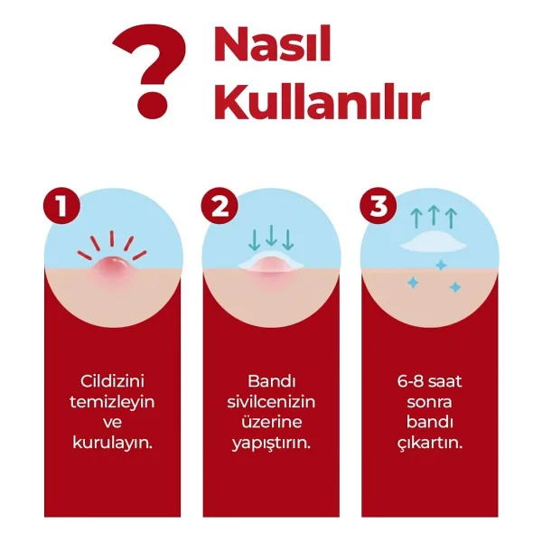 kleccs Sivilce Bandı, Aktif-Hızlı Sonuç, 144 Adet, Hidrokolloid Akne Bandı - Görsel 5