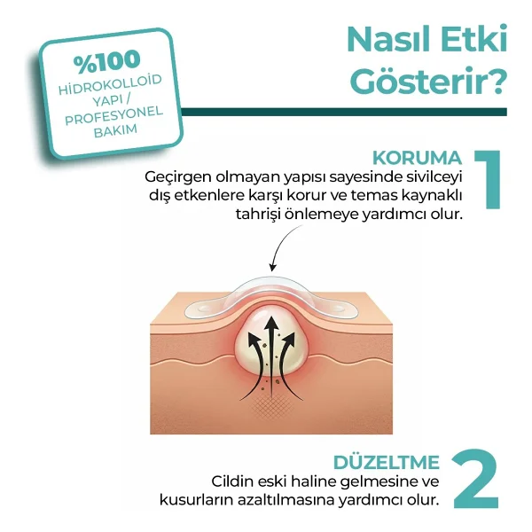 kleccs Sivilce Bandı, Orijinal-Profesyonel Bakım, 144 Adet, Hidrokolloid Akne Bandı - Görsel 4