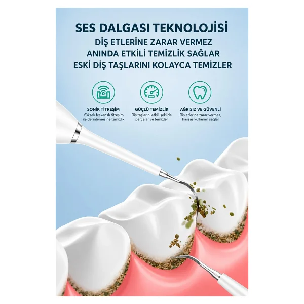 Exenar Diş Taşı Temizleme Cihazı Şarjlı Diş Fırçası Sonik Ultrasonik Akıllı Diş Taşı Temizleyici 5 Mod Ipx8 - Siyah - Görsel 5