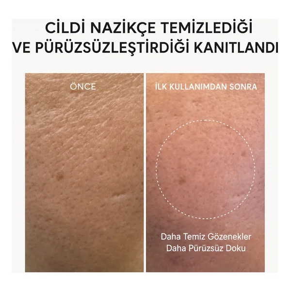 - Fresh Rosehip Rice Mochi Cleanser(Nemlendirici Temizleyici) 120 gr - Görsel 7