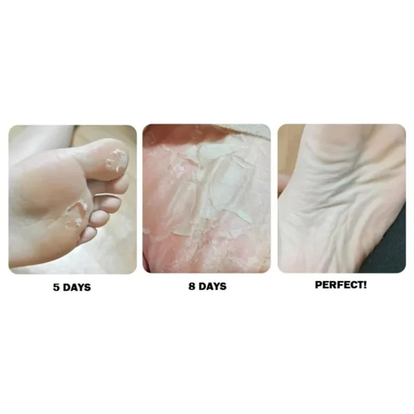 Rituel De Beaute Purederm Ayak Ölü Deri Soyucu Peeling Ayak Maskesi (46 Ayak Numarasına Kadar Uyu - Görsel 2