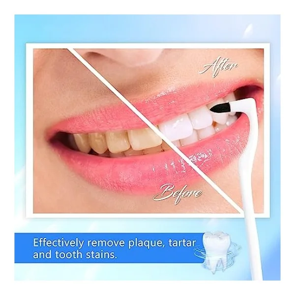 Sularpek 3 adet diş taşı çıkarıcı, diş fırçası leke çıkarıcı, diş parlatıcı, profesyonel diş temizliği, renk değişimleri, plak ve diş taşlarını giderir (karışık renkler) - Görsel 5