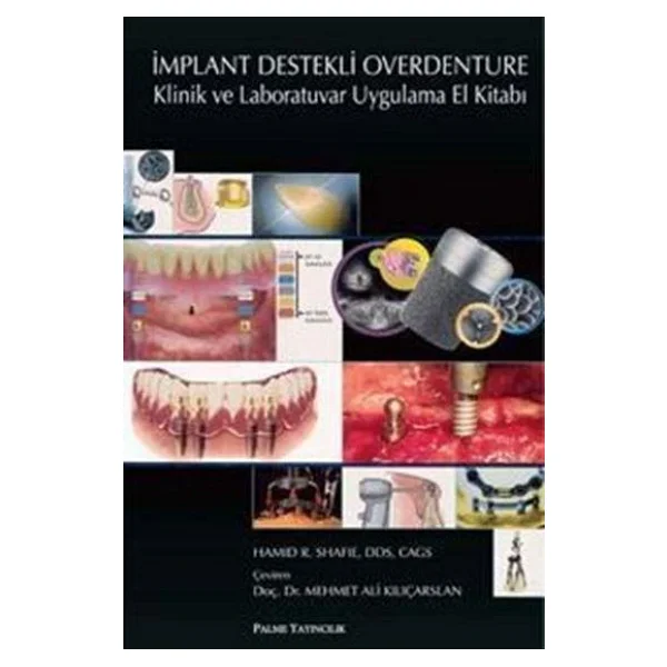 Palme Yayınevi İmplant Destekli Overdenture Klinik Ve Laboratuvar Uygulama El Kitabı - Görsel 3