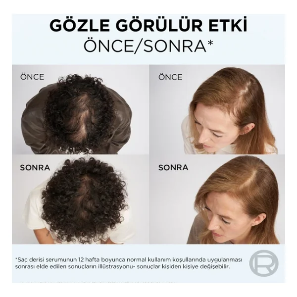L'oreal Paris Elseve Growth Booster Dökülme Karşıtı 102 Ml Saç Serumu - Görsel 6