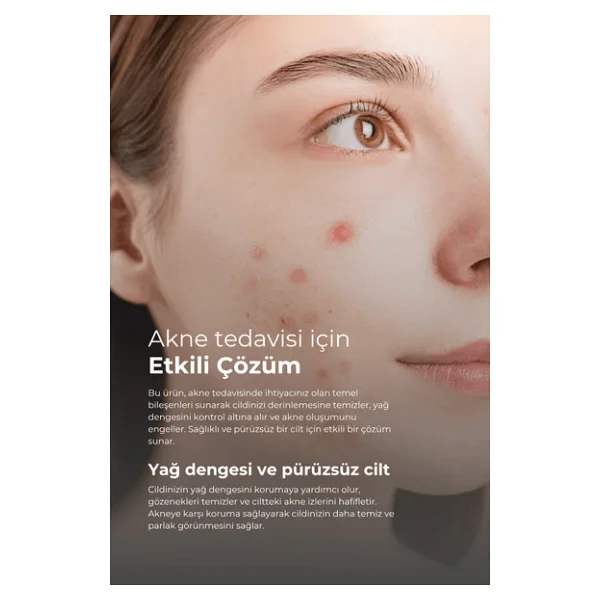 Tto Akne Ve Rozasea Bakım Seti Temizleme Jeli Dermodicos Plus - Görsel 4
