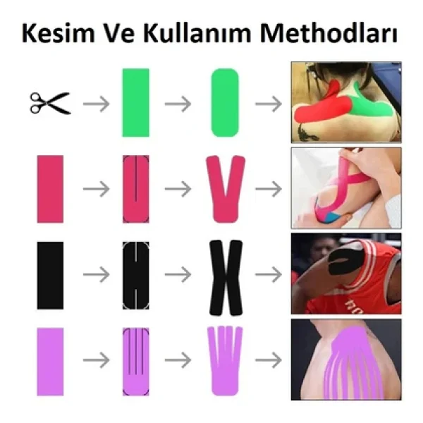 Ac-150 Yüz & Vücut Uyumlu Hipoalerjenik Kinesyo Tape Ağrı Bandı 5m X 5cm Mor Renk 1 Beden - Görsel 5