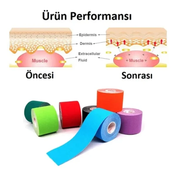 Ac-150 Yüz & Vücut Uyumlu Hipoalerjenik Kinesyo Tape Ağrı Bandı 5m X 5cm Mor Renk 1 Beden - Görsel 2