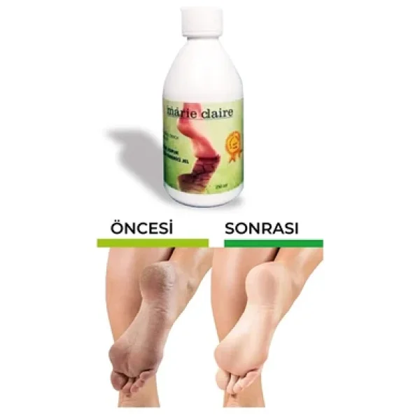 Marie Claire Ayak Bakımı Nasır Topuk Çatlak Giderici Jel 250ml Güçlü Formül - Görsel 5