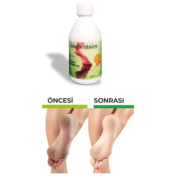Marie Claire Ayak Bakımı Nasır Topuk Çatlak Giderici Jel 250ml Güçlü Formül - Görsel 8