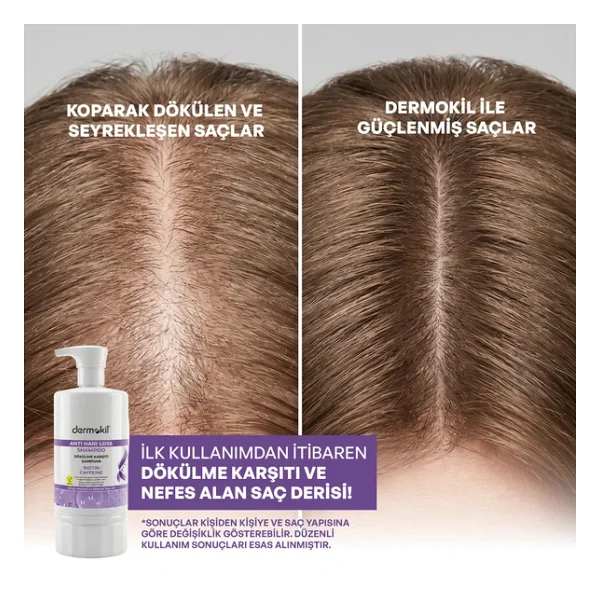 Dermokil Biotin & Caffeine 950 Ml Saç Dökülmesine Karşı Şampuan - Görsel 6