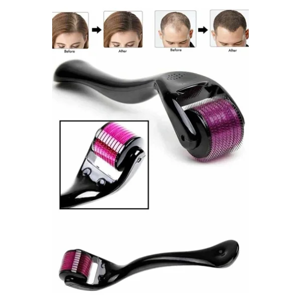 Derma Roller Titanyum Uçlu 540 Iğneli 1 Mm Saç Sakal Çıkarma Ve Cilt Bakım Masaj Aleti - Görsel 4