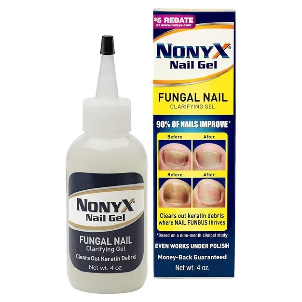 Nonyx Nail Gel 113gr - Görsel 3