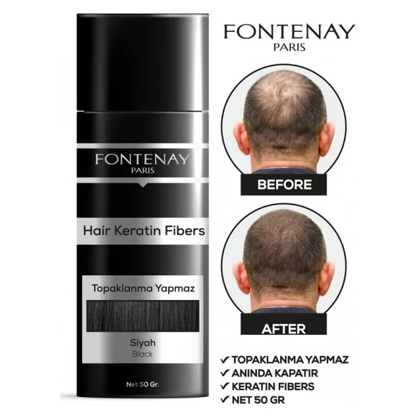 Fontenay Saç Dolgunlaştırıcı Keratin Fibers Siyah Topik Saç Tozu 50gr + Saç Spreyi 400ml 2'li Set 2 - Görsel 5