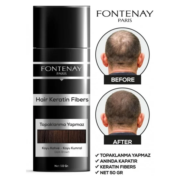 Fontenay Saç Dolgunlaştırıcı Keratin Fibers Koyu Kahve Topik Saç Tozu 50Gr + Saç Spreyi 400Ml 2Li Set 2 - Görsel 7