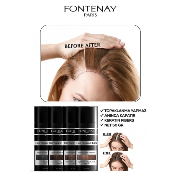 Fontenay Saç Dolgunlaştırıcı Keratin Fibers Siyah Topik Saç Tozu 50gr X3 - Görsel 7